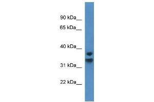 Western Blot showing NFKBID antibody used at a concentration of 1-2 ug/ml to detect its target protein. (NFKBID antibody  (C-Term))