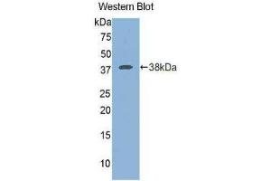 Western Blotting (WB) image for anti-Islet Cell Autoantigen 1, 69kDa (ICA1) (AA 1-257) antibody (ABIN1175749) (ICA1 antibody  (AA 1-257))