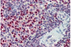 Spleen, Human: Formalin-Fixed, Paraffin-Embedded (FFPE) (FCHO1 antibody  (AA 468-517))