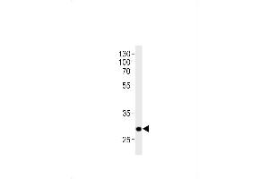 DANRE hoxc9a Antibody (C-term) Azb10016a western blot analysis in zebra fish brain tissue lysates (35 μg/lane). (HOXC9 antibody  (C-Term))