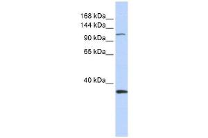 MCM2 antibody used at 1 ug/ml to detect target protein. (MCM2 antibody  (Middle Region))