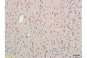 Formalin-fixed and paraffin embedded rat brain labeled with Anti SCN3B Polyclonal Antibody, Unconjugated (ABIN872574) followed by conjugation to the secondary antibody and DAB staining (SCN3B antibody  (AA 21-120))