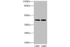 Western blot All lanes: LIAS antibody at 2 μg/mL Lane 1: MCF-7 whole cell lysate Lane 2: K562 whole cell lysate Secondary Goat polyclonal to rabbit IgG at 1/10000 dilution Predicted band size: 42, 37, 38 kDa Observed band size: 42 kDa