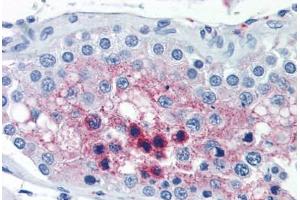 Human Testis (formalin-fixed, paraffin-embedded) stained with CTSL2 antibody ABIN351497 at 10 ug/ml followed by biotinylated anti-mouse IgG secondary antibody ABIN481714, alkaline phosphatase-streptavidin and chromogen. (Cathepsin L2 antibody)