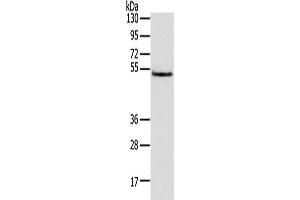 Gel: 8 % SDS-PAGE,Lysate: 40 μg,Primary antibody: ABIN7131472(TRIM14 Antibody) at dilution 1/800 dilution,Secondary antibody: Goat anti rabbit IgG at 1/8000 dilution,Exposure time: 3 seconds