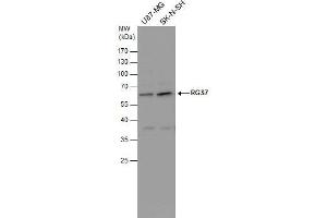 WB Image RGS7 antibody detects RGS7 protein by western blot analysis. (RGS7 antibody)