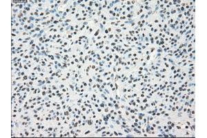 Immunohistochemical staining of paraffin-embedded Kidney tissue using anti-LTA4Hmouse monoclonal antibody. (LTA4H antibody)