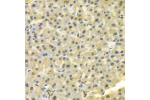 Immunohistochemistry of paraffin-embedded mouse pancreas using DKC1 Antibody (ABIN5970956) at dilution of 1/100 (40x lens). (DKC1 antibody)