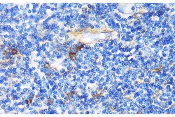 Patched 1 antibody