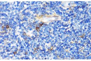 Immunohistochemistry of paraffin-embedded Human tonsil using PTCH1 Polyclonal Antibody at dilution of 1:100 (40x lens). (Patched 1 antibody)