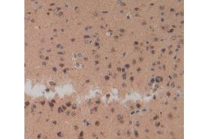 Used in DAB staining on fromalin fixed paraffin-embedded Brain tissue (NPS antibody  (AA 26-89))