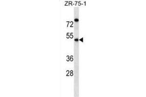 Western Blotting (WB) image for anti-Essential Meiotic Endonuclease 1 Homolog 2 (EME2) antibody (ABIN2998688) (EME2 antibody)