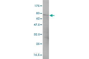 CTNNA3 monoclonal antibody (M01), clone 3F4-1B11 Western Blot analysis of CTNNA3 expression in HepG2 . (CTNNA3 antibody  (AA 1-376))