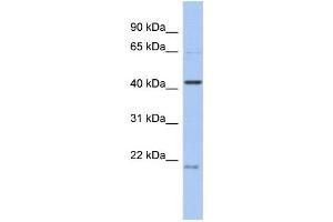 WB Suggested Anti-FAM98B Antibody Titration: 0. (FAM98B antibody  (N-Term))