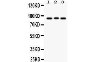 Western Blotting (WB) image for anti-Sema Domain, Immunoglobulin Domain (Ig), Short Basic Domain, Secreted, (Semaphorin) 3A (SEMA3A) (AA 550-771) antibody (ABIN3043328) (SEMA3A antibody  (AA 550-771))