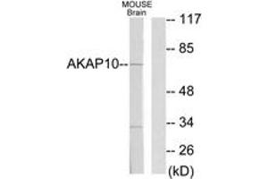 Western Blotting (WB) image for anti-A Kinase (PRKA) Anchor Protein 10 (AKAP10) (AA 10-59) antibody (ABIN2889325) (AKAP10 antibody  (AA 10-59))