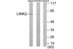 Western blot analysis of extracts from HepG2 cells and HUVEC cells, using LIMK2 antibody. (LIMK2 antibody  (Internal Region))