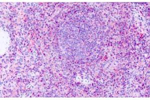 Anti-GPR63 antibody IHC staining of human spleen. (GPR63 antibody  (Extracellular Domain))
