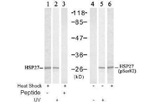 Image no. 2 for anti-Heat Shock 27kDa Protein 1 (HSPB1) (pSer82) antibody (ABIN197004) (HSP27 antibody  (pSer82))