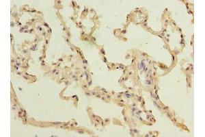 Immunohistochemistry of paraffin-embedded human lung tissue using ABIN7172926 at dilution of 1:100