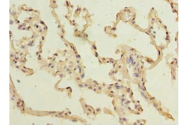 TM4SF1 anticorps  (AA 115-161)