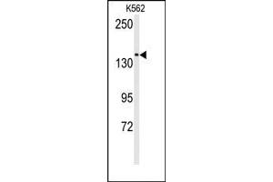 Image no. 1 for anti-Transient Receptor Potential Cation Channel, Subfamily M, Member 7 (TRPM7) (N-Term) antibody (ABIN360498) (TRPM7 antibody  (N-Term))