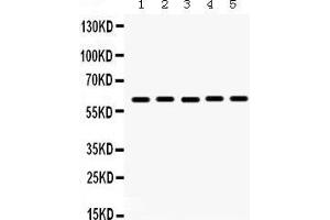 Western Blotting (WB) image for anti-Monoamine Oxidase A (MAOA) (AA 457-493), (C-Term) antibody (ABIN3043872) (Monoamine Oxidase A antibody  (C-Term))