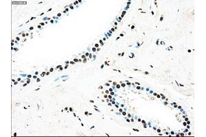 Immunohistochemical staining of paraffin-embedded breast tissue using anti-TYRO3 mouse monoclonal antibody.