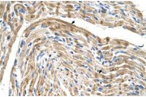 Immunohistochemical staining (Formalin-fixed paraffin-embedded sections) of human muscle with FADS1 polyclonal antibody  at 4-8 ug/mL working concentration.
