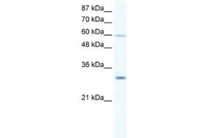 Western Blotting (WB) image for anti-DEAD (Asp-Glu-Ala-Asp) Box Polypeptide 31 (DDX31) antibody (ABIN2461359) (DDX31 antibody)