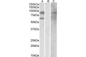 HEK293 lysate (10ug protein in RIPA buffer) overexpressing Human RACGAP1 with DYKDDDDK tag probed with ABIN184690 (0. (RACGAP1 antibody  (C-Term))