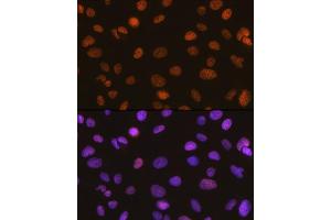 Immunofluorescence (IF) image for anti-SWI/SNF Related, Matrix Associated, Actin Dependent Regulator of Chromatin, Subfamily A, Member 5 (SMARCA5) antibody (ABIN7270656)