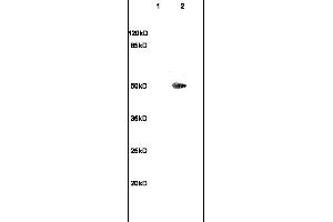 Formalin-fixed and paraffin embedded rat brain labeled with Anti-TUBB3 Polyclonal Antibody, Unconjugated (ABIN706736) at 1:200 followed by conjugation to the secondary antibody and DAB staining (TUBB3 antibody  (AA 401-450))