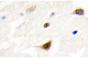 Immunohistochemistry analyzes of TRF1 antibody in paraffin-embedded human brain tissue. (TRF1 antibody)
