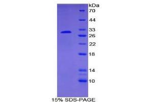 SDS-PAGE analysis of Human Smad6 Protein.