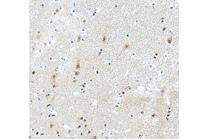 IHC analysis of PKC Epsilon/PRKCE using anti-PKC Epsilon/PRKCE antibody (ABIN3043908). (PKC epsilon antibody  (AA 53-236))