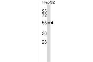 Western Blotting (WB) image for anti-WEE1 Homolog 2 (S. Pombe) (WEE2) antibody (ABIN2998010)