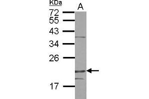 Western Blotting (WB) image for anti-Density-Regulated Protein (DENR) (AA 1-198) antibody (ABIN1501885) (Density Regulated Protein antibody  (AA 1-198))