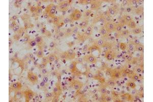 IHC image of ABIN7127534 diluted at 1:215 and staining in paraffin-embedded human liver tissue performed on a Leica BondTM system. (Recombinant Hepcidin antibody)