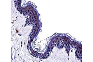 Tyrosinase antibody immunohistochemistry analysis in formalin fixed and paraffin embedded human skin tissue. (TYR antibody  (AA 486-513))