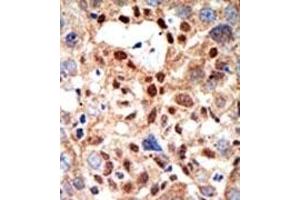 Image no. 2 for anti-Promyelocytic Leukemia (PML) (Sumoylation Site) antibody (ABIN357734) (PML antibody  (Sumoylation Site))