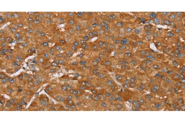 PAGE5 antibody