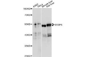 Western blot analysis of extracts of various cell lines, using SRSF6 antibody (ABIN6293560) at 1:1000 dilution. (SFRS6 antibody)