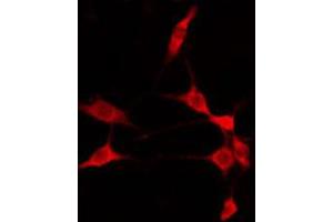 ABIN6274810 staining 293 by IF/ICC. (ADAM32 antibody  (C-Term))