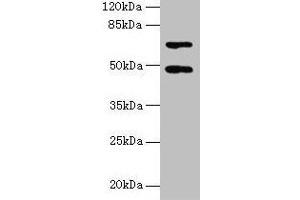 Western blot All lanes: HDAC3 antibody at 2 μg/mL + Hela whole cell lysate Secondary Goat polyclonal to rabbit IgG at 1/10000 dilution Predicted band size: 49, 50 kDa Observed band size: 49 kDa (HDAC3 antibody  (AA 1-428))