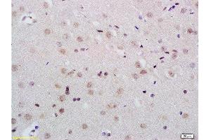 Formalin-fixed and paraffin embedded rat brain tissue labeled with Anti-KDM5B/PLU1/Jarid1B Polyclonal Antibody, Unconjugated  at 1:200 followed by conjugation to the secondary antibody and DAB staining (KDM5B antibody  (AA 65-165))