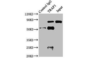Immunoprecipitating TRAP1 in Jurkat whole cell lysate Lane 1: Rabbit control IgG instead of ABIN7154903 in Jurkat whole cell lysate. (TRAP1 antibody  (AA 60-308))