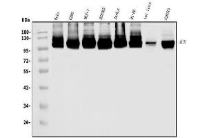 Western blot analysis of MCM4 using anti-MCM4 antibody (ABIN7601485).