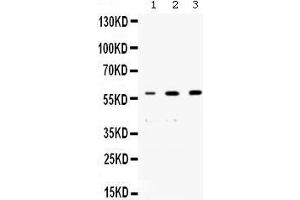 Western blot analysis of nmt55/p54nrb expression in rat brain extract (lane 1), human placenta extract (lane 2) and PANC whole cell lysates (lane 3).