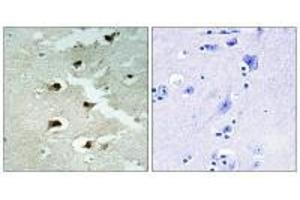Immunohistochemistry analysis of paraffin-embedded human brain tissue using CDCA4 antibody. (CDCA4 antibody)